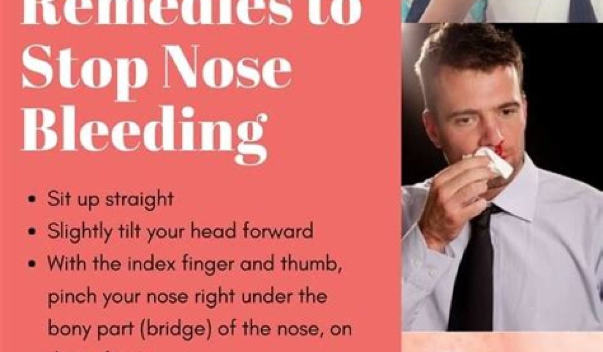 How To Stop Nose Bleed